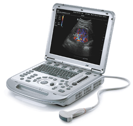 Image: The M7 ultrasound system (photo courtesy Mindray Medical International).